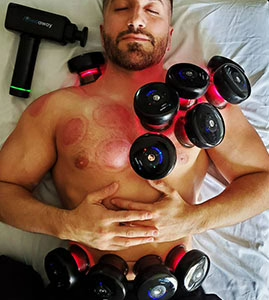 Achedaway Cupper - The Smart Cupping Therapy Massager (Par)